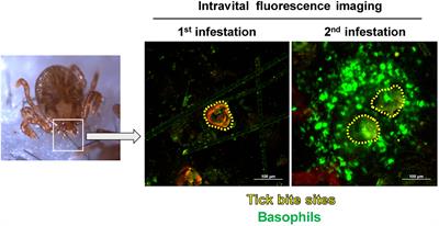 Crucial Role for Basophils in Acquired Protective Immunity to Tick Infestation